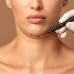 ניתוח מוהס בסנטר